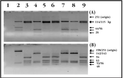 Figure 1- Electrophoresis through a 4% Metaphor agarose of restriction digests carried out on the 251 bp PCR fragment