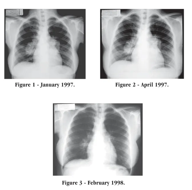 Figure 3 - February 1998.