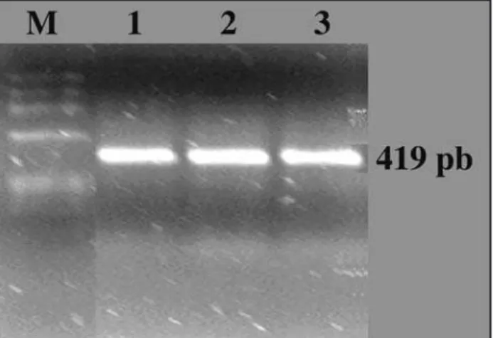 Figure 3 - Multiple alignment NS1 genes of dengue virus type 1 isolated  in Rondônia, Western Island (U88535); Mochizuki (AB074760); Cambodia  (AF309641) and Singapore (M87512), showing high similarity.