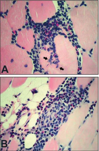 Figure 3 - Distribution of mice in relation to the intensity of eosinophilia  in tissue inflammatory processes, according to: A - immunization with  Trypanosoma cruzi-like strain RM1 (p = 0.84); B - number of inoculations  (p = 0.015).
