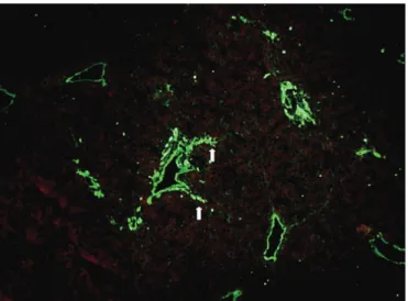 FIgURE 2 - Staining for laminin reveals the presence of blood vessel basement  membranes and marks earlier septa developing from portal space