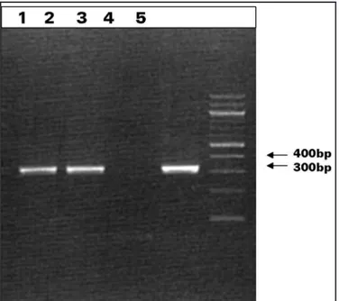 FIgURE 3 - Lane1 and 2 show the 330-bp fragment ampliied for the isolated sample  of Akodon molinae