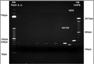 FIGURE 1 - PCR products digested by restriction enzymes.