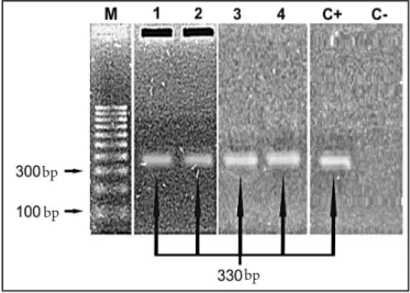 FIGURE 3 - Ampliication products obtained using S35 and S36 primers for  Trypanosoma cruzi