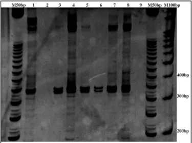 FIGURE 1 - Electrophoresis in 10% polyacrylamide gel showing the PCR results  for DNA extracted from blood