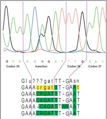 FIGURE  1  -  Part  of  the  electropherogram  of  the  HIV-1  protease  genomic  sequence, showing the insertion of two amino acids between codon 35 and 36