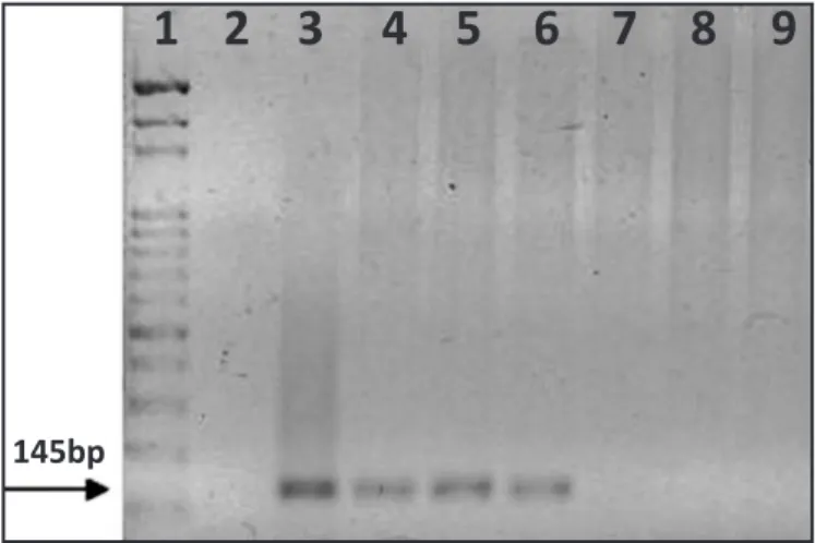 FIGURE 2 - Electrophoretic proile on agarose gel of 145-bp amplicons obtained  by PCR using the primers RV1/RV2