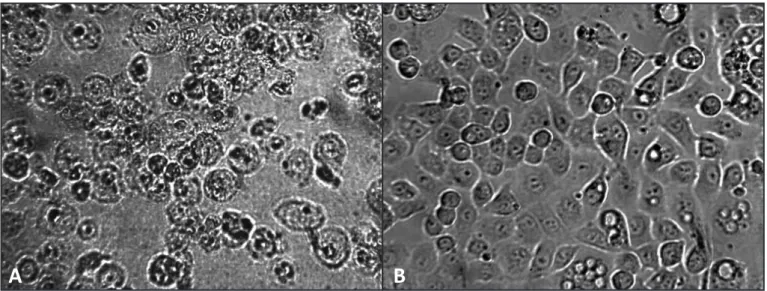 FIGURE 1 – Morphology of LLC-MK2 cells ater (A) Toxoplasma gondii infection and (B) artesunate treatment following parasite challenge