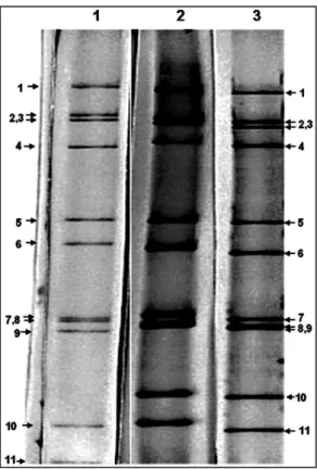 FIGURE 1 - A rotavirus PAGE proile before the introduction  Rotarix in the Brazilian Expanded Immunization Program.