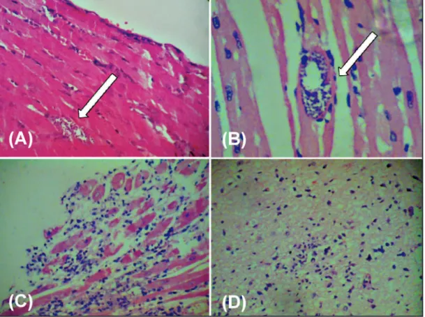 TABLE 4 - Histopathological parameters (tissue parasitism and inlammatory process) in mice  inoculated with Trypanosoma cruzi stocks from the State of Amazonas, Brazil.