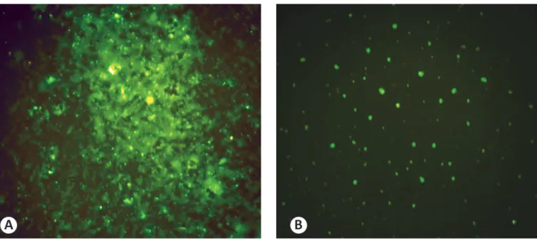 FIGURE 1 - Photomicrographs of direct immunoﬂ uorescence reactions in the presence (A and B) of rabies virus antigens in the brain tissue samples subjected to  cryopreservation at -20ºC for up to 2 years (immunoﬂ uorescence microscope equipped with 400X ma