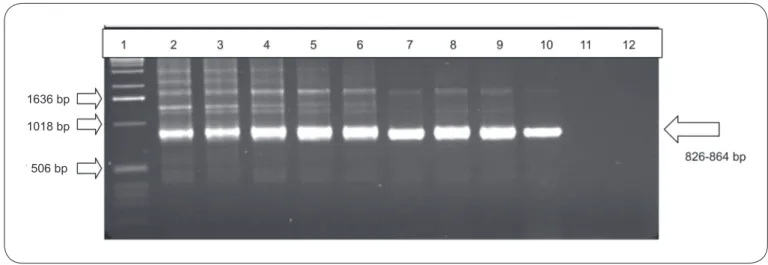 FIGURE 1 - Agarose gel electrophoresis (1.6%) showing genetic fragment ampliﬁ cation products from Nested-PCR performed with the XIAO primers  with  different concentrations of Cryptosporidium parvum oocysts; DNA was extracted with a commercial kit®