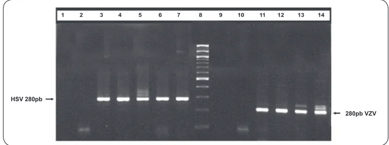 FIGURE 1 - Ampliﬁ ed viral nucleic acids from commercial control dilutions after agarose gel electrophoresis, ethidium bromide staining and UV transillumination