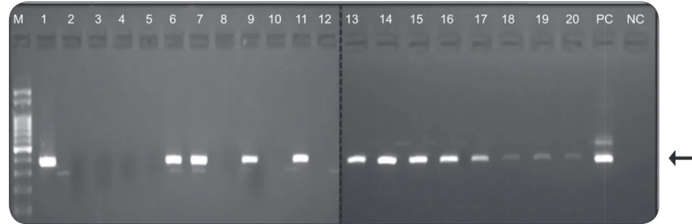 FIGURE 4 - Agarose gel electrophoresis of the PCR products obtained after  amplifying the total phlebotomine sandﬂ y DNA with primers for the cacophony  IV6 gene of Lutzomyia