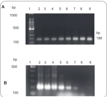 FIGURE 3 - PCR using the primer pair TCZ1/TCZ2 and blood from patients  positive for Chagas disease