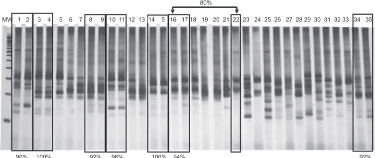 FIGURE 1- Polyacrylamide gel (7.5%) stained with silver, representing the genetic proiles of Trypanosoma cruzi isolates obtained  using LSSP-PCR
