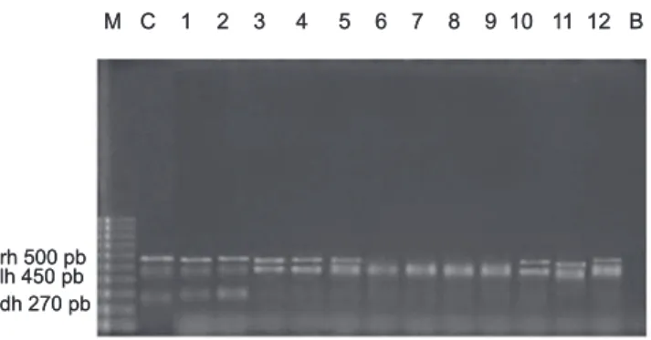 FIGURE 2 - Agarose gel electrophoresis of the multiplex PCR  products obtained from the collected Vibrio parahaemolyticus  strains
