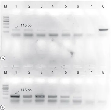 TABLE 1 - Comparison of the four protocols for DNA extraction in  urine.