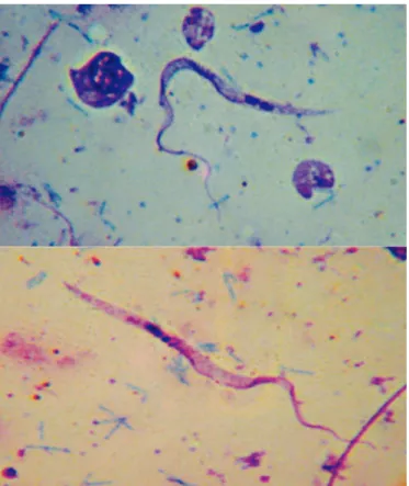 FIGURE 2 - Epimastigote form of Trypanosoma rangeli at 1600X  magniﬁ cation.