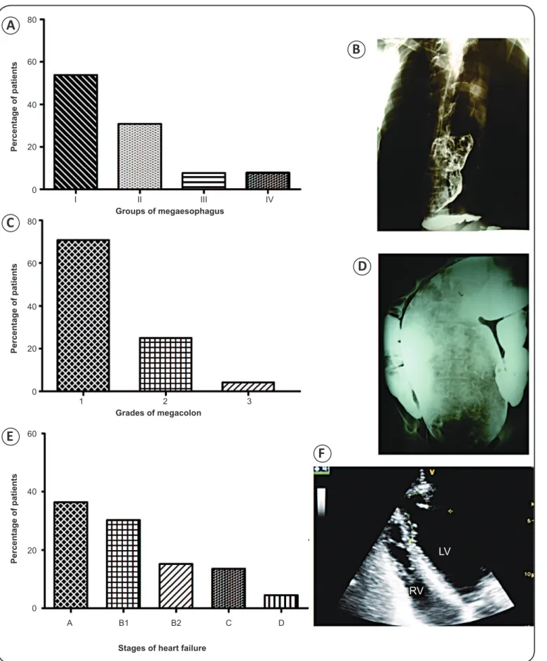 FIGURE 2 - The clinical evolution of Chagas disease. A. Patients were categorized into different groups of megaesophagus, and B