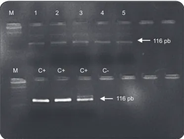 FIGURE 1 -  Electrophoretic analysis of PCR 13a/13b fragments.