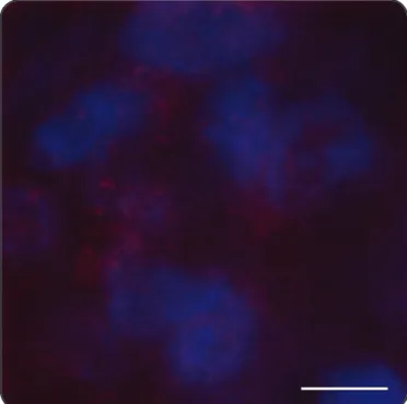 FIGURE  2  -  Staining  of  Leishmania   parasites  in  infected  skin.