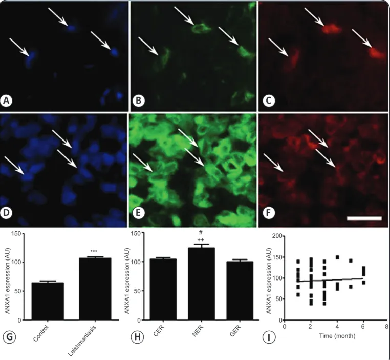 FIGURE  3  - ANXA1  expression  in  CD163 +  macrophages in Leishmania -infected  skin