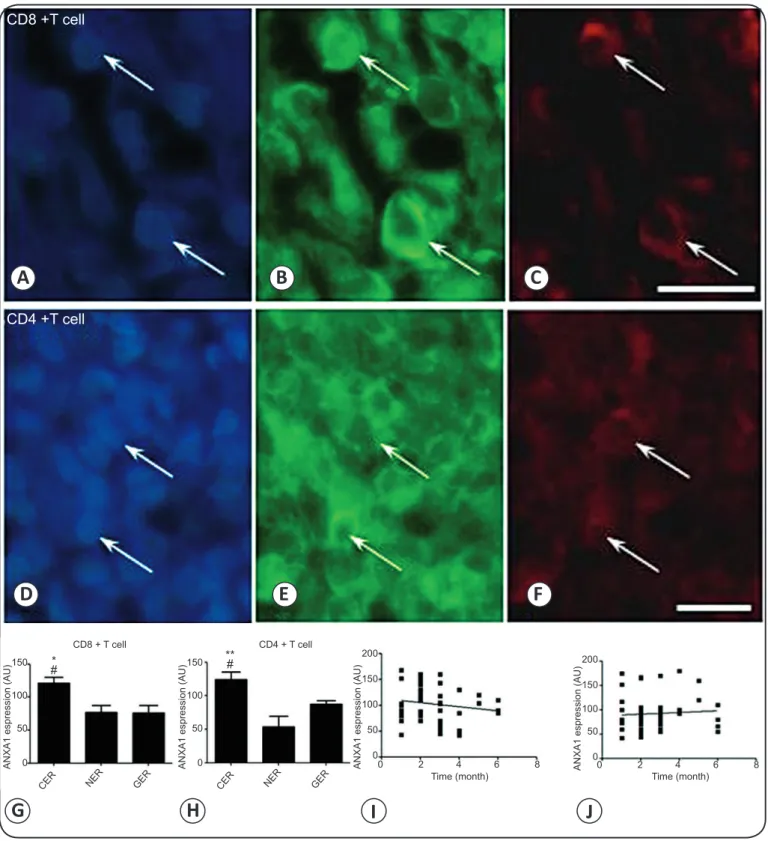 FIGURE 4 - ANXA1 expression in CD4 +  and CD8 +  T cells in Leishmania -infected skin