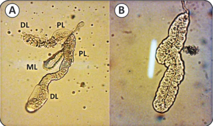 FIGURE 1 -  Single salivary glands from adult Anopheles  sundaicus mosquitoes. A) A female salivary gland