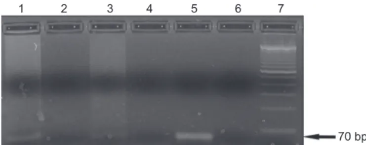 FIGURE 1 - PCR showing the fragment of the 70-bp  region of minicircle kDNA of the subgenus Leishmania  (Viannia)