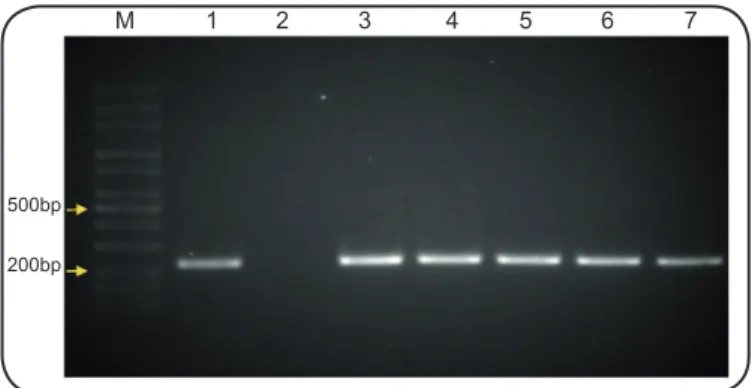 FIGURE 2. PCR ampliﬁ cation of the bla SHV  gene. Lane M:100 bp-3k b ladder; 