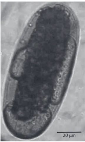 FIGURE 1. A Meloidogyne egg showing a thin, hyaline shell and refractive  internal corpuscles located between the shell and the morula, resembling lipid  droplets.