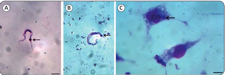 FIGURE 1 - Identiication of a  Trypanosoma cruzi strain isolated from Panstrongylus megistus