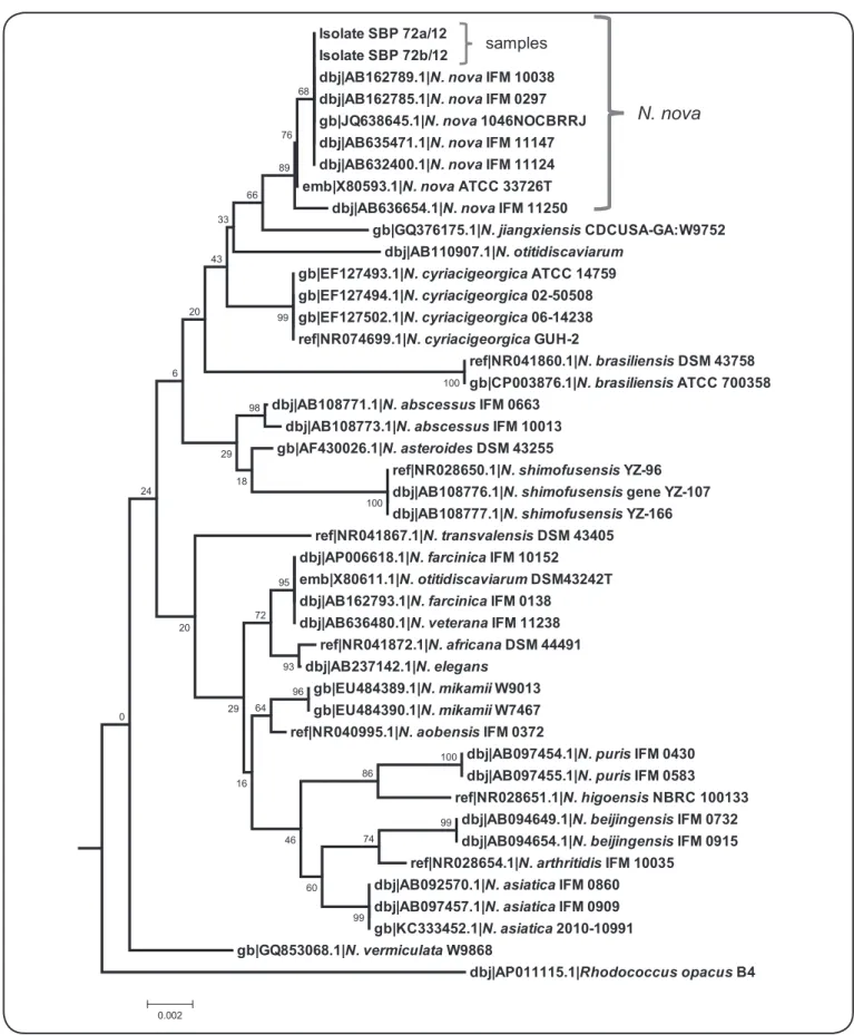 FIGURE 2. Nucleotide sequence analysis. Phylogenetic relationship derived from 16S rDNA sequences showing the homology between Nocardia nova (samples  SBP 72a/12 and SBP 72b/12) and 16S rDNA sequences of other Nocardia species