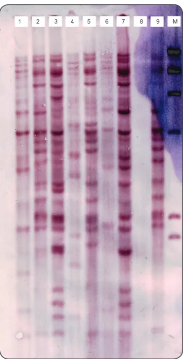 FIGURE 1 - IS6110-based DNA ingerprints of Mycobacterium tuberculosis  strains isolated from Tehran