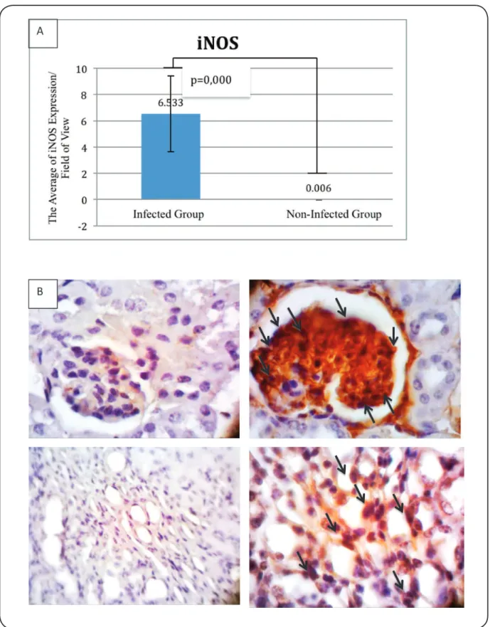 FIGURE 4 - A: iNOS expression (positive cells) per ield of view. B: The expression of iNOS in the non-infected group (left, ×1,000) and infected  group (right, ×1,000)