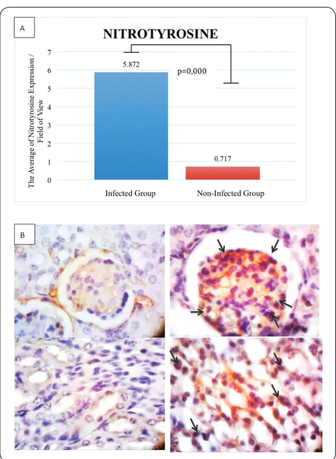 FIGURE 5 - A: Nitrotyrosine expression (positive cells) per ield of view. B: The expression of nitrotyrosine in the non-infected group  (left, ×1,000) and infected group (right, ×1,000)