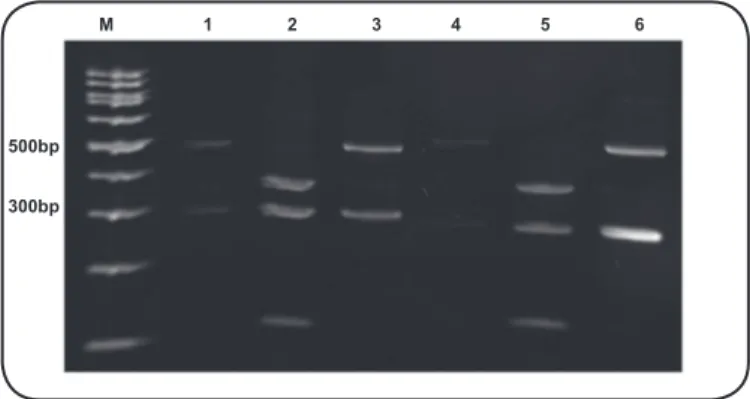 FIGURE 2 - Polyacrylamide gel electrophoresis (5%) of the PCR products  resulting from the digestion of laB by the restriction endonucleases  HindIII and HaeIII