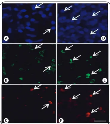 FIGURE 1 - Immunoluorescence analysis for CCR5 and CCR4. Figure 1  A, B and C: Tuberculoid leprosy patients with lymphocytes immunostained  for DAPI (Panel A), CD4 (Panel B), and CCR5 (Panel C)