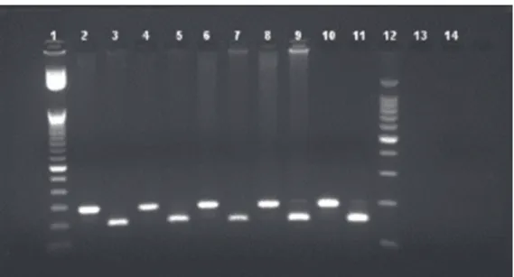 FIGURE 2 - Agarose gel analysis of the 14676 region RFLP-PCR SmlI-digested and undigested fragments
