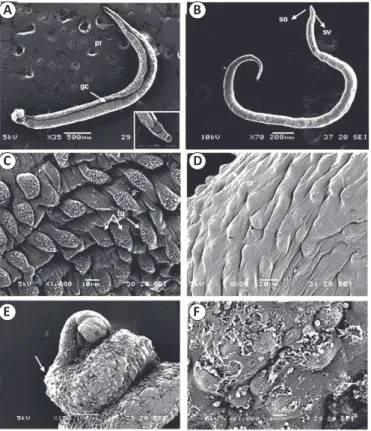 FIGURE 2 - (A-F) Micrographs of adult Schistosoma mansoni  worms. (A-B) Micrographs of untreated adult worms