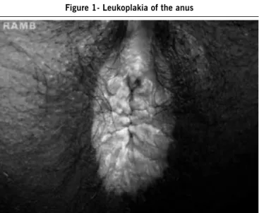 Figure 1- Leukoplakia of the anus