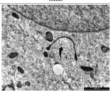 Figure 1 - Growth of suggestive structures of spirochetes after  inoculation of blood of bYs patient in sP4 culture setting