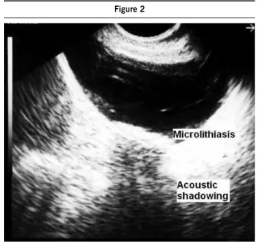Figure 1 Figure 2