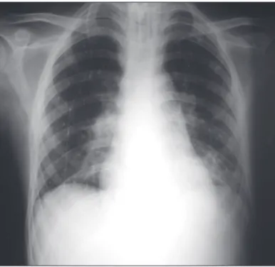 Figure 1 – Lateral x-ray. Figure 2 – PA x-ray.