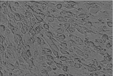 Figure 1 – ATCC CL 60 (SIRC) cells infected during seven  days with urine sample from case no