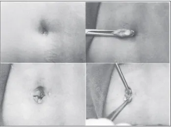 FIGURE 2  Sitracc ® .