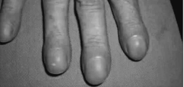 FIGURE 3   Large mass occupying the right hemithorax.