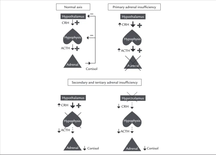FIGURE 1   Schematic comparison of the adrenal physiology and pathophysiology of the adrenal insufficiency.