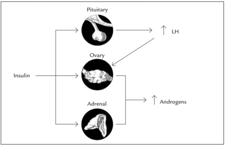 FIGURE 1   The influence of insulin in the amplification of LH and  increase in androgen levels.
